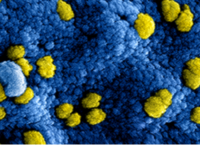 Virus Virus